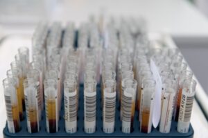 За сутки в Волгоградской области COVID-19 обнаружили у 104 человек