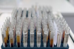 Еще 274 волгоградца заболели коронавирусом за сутки и 6 умерли