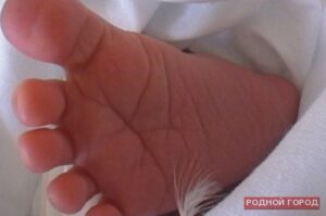 Под Волгоградом 3-месячную девочку покалечил 3-летний брат