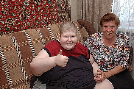 100-килограммовый мальчик из Волгограда умер в 19 лет