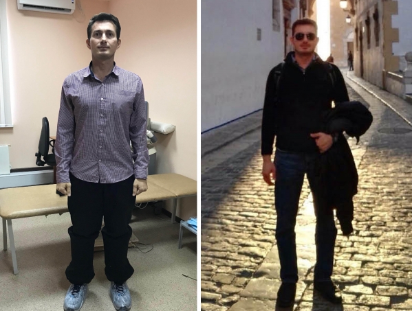 Волгоградские медики выпрямили ноги испанскому моднику