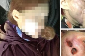 История изуродованной женщины: “Пластика сломала мне жизнь!”