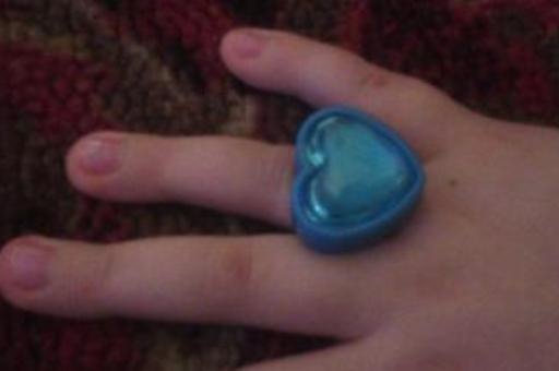 В Волгограде спасатели распилили кольцо на пальце 5-летнего ребенка