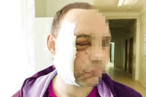40-летний волгоградец выжил после выстрела из ружья в лицо
