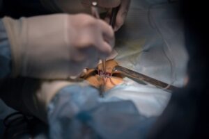Нейрохирурги Волгограда будут лечить эпилепсию по новой методике