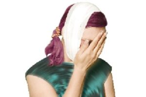 Лицо волгоградки гниет после неудачной пластики?