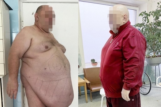 Волжанин с генетическим заболеванием: «Мне помогают любимая жена и дети!»