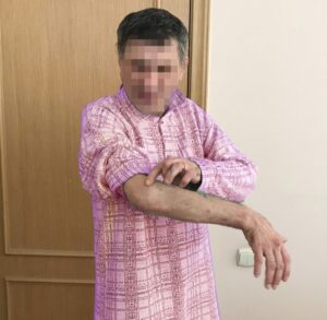 «Пошел разбираться с долгом, а угодил в травмпункт»: чем заканчивается кредитное рабство